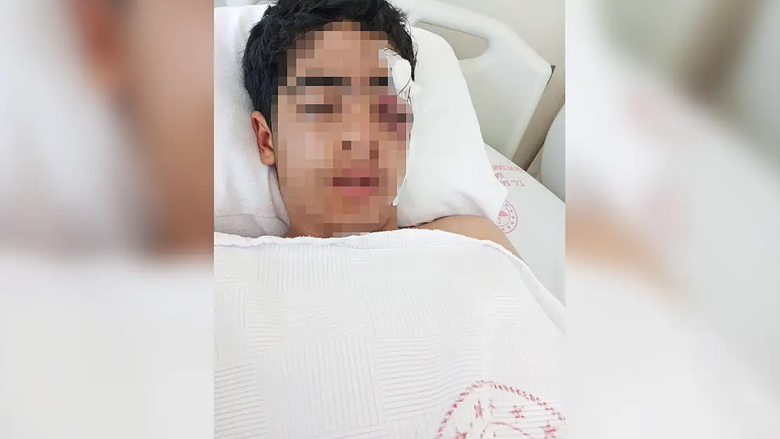 Akran zorbalığı dehşet saçtı! 15 yaşındaki çocuk öldüresiye dövüldü