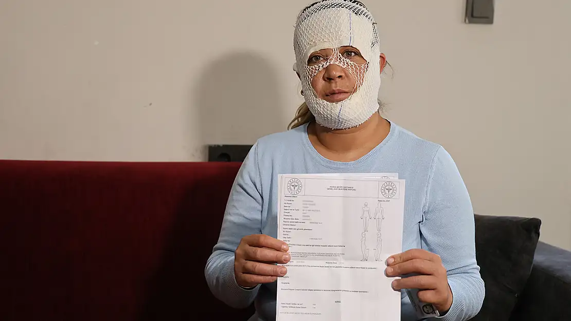 Güzelleşmek uğruna yüzünden oldu!