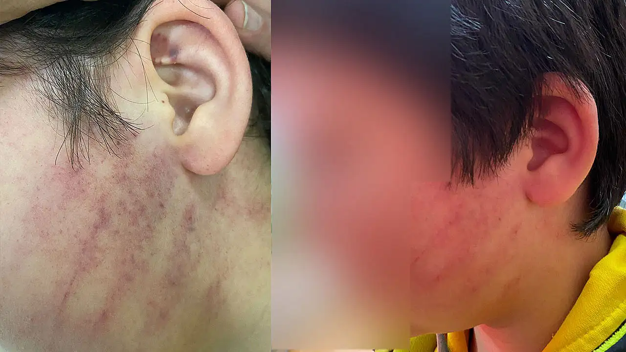 Konya'da okulda skandal: Çocukları veliler darp etti!