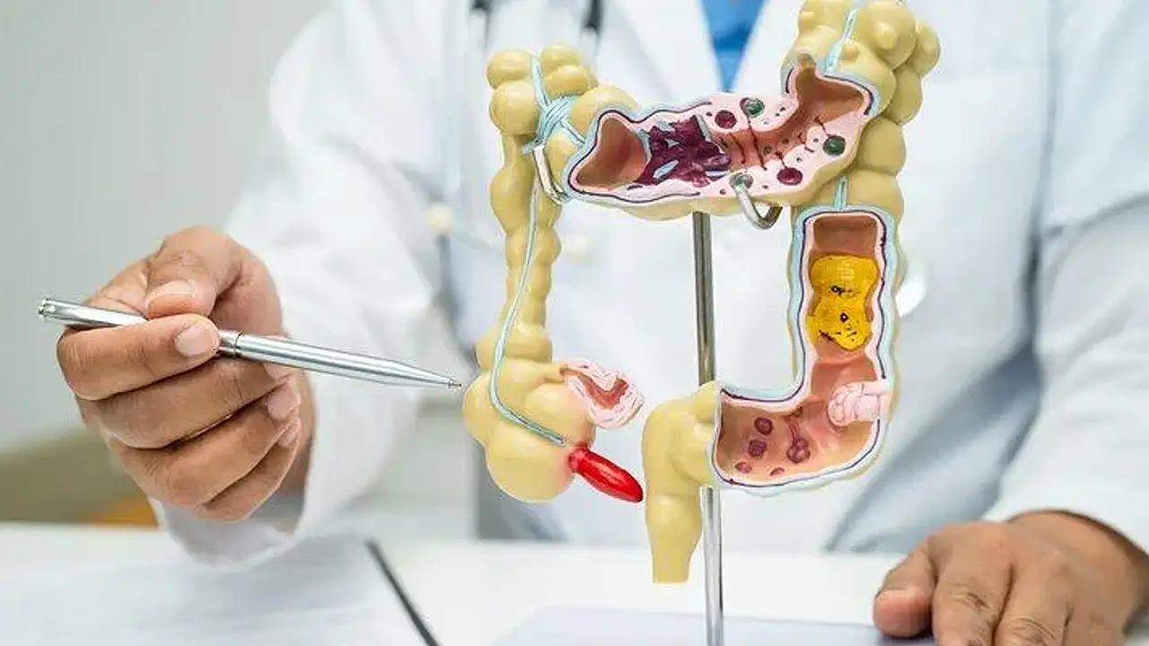 Genel Cerrahi Uzmanı Doç. Dr. Alparslan Şahin makattan dışarı sarkan kısmın çıkarılarak bağırsak bütünlüğünün sağlandığı ağrısız cerrahi yöntemi anlattı.