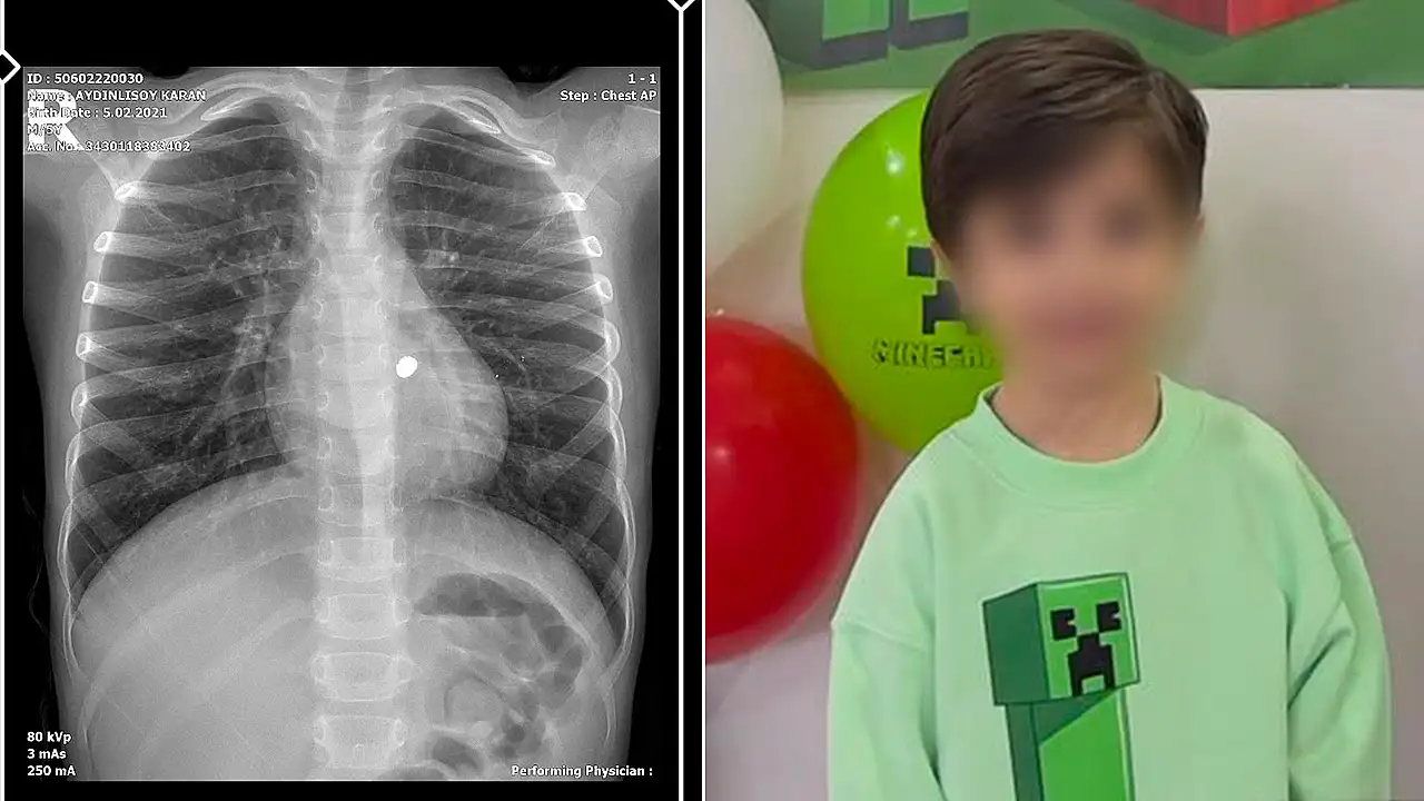 Havuz keyfi kabusa döndü: Beş yaşındaki çocuğa dürbünlü kurşun