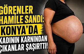 Görenler hamile sandı: Konya'da kadının karnından çıkanlar şaşırttı