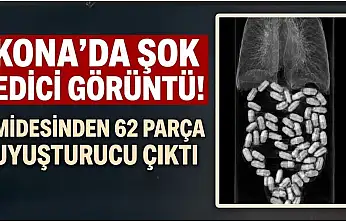 Konya'da midesinden 62 parça uyuşturucu çıktı