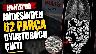 Konya'da midesinden 62 parça uyuşturucu çıktı