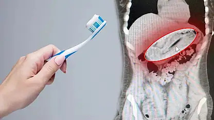Doktorlar gözlerine inanamadı! Zayıflamak için diş fırçası yuttu