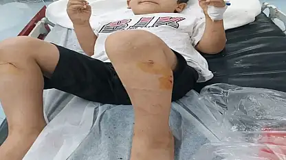Sokak köpeklerinin saldırısına uğrayan Abdulkadir, yaralandı