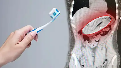 Doktorlar gözlerine inanamadı! Zayıflamak için diş fırçası yuttu