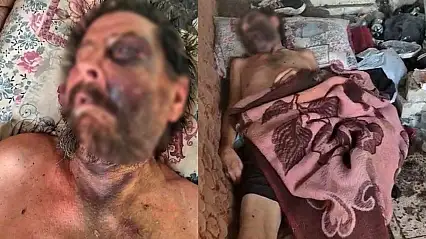 Metruk evde insanlık dramı! Çöpler arasında can çekişiyordu