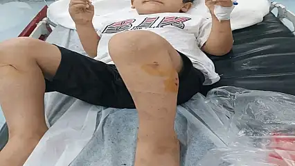 Sokak köpeklerinin saldırısına uğrayan Abdulkadir, yaralandı