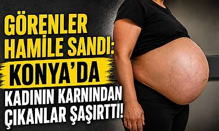 Görenler hamile sandı: Konya'da kadının karnından çıkanlar şaşırttı