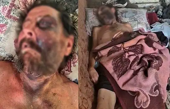 Metruk evde insanlık dramı! Çöpler arasında can çekişiyordu