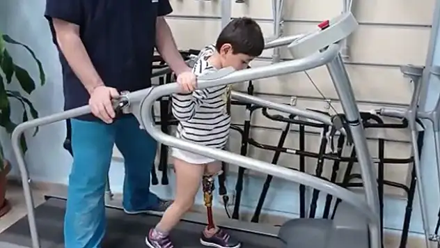 'Baba koşabilecek miyim?' diye soran Özge protezine kavuştu
