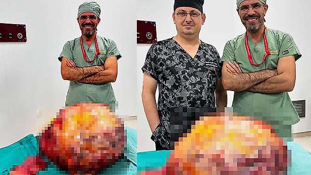 'Karın ağrısı' şikayetiyle hastaneye giden hastanın karnından 26 kiloluk tümör çıktı
