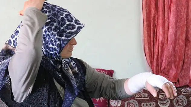 'Komşum beni darp etti' dedi, yaşadığı dehşeti anlattı
