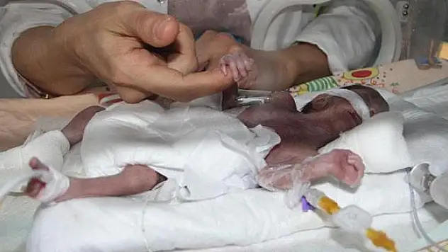 'Parmak bebek' hayata tutundu