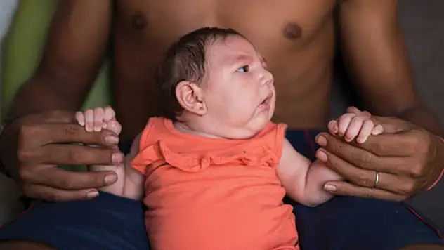 'Zika virüsü artış eğiliminde'