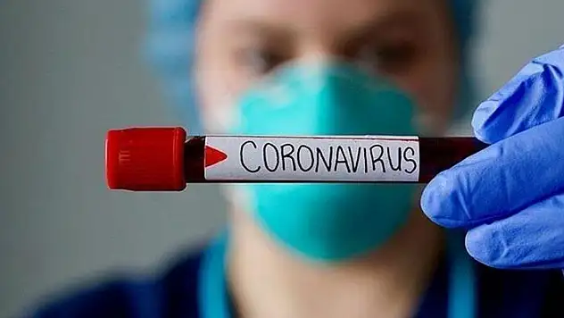 1 Haziran koronavirüs tablosu! Vaka, Hasta, ölü sayısı ve son durum açıklandı
