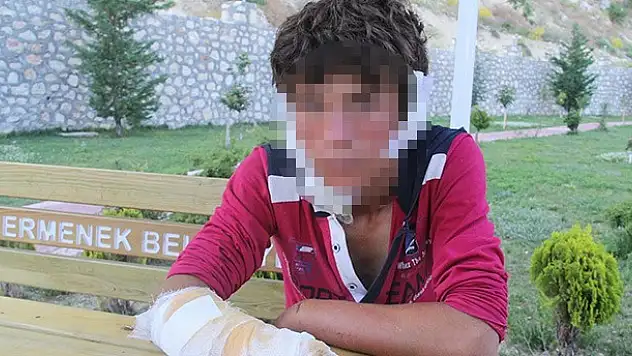16 yaşındaki çobana kızgın demirle işkence