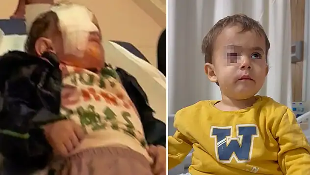 2 yaşındaki Alpaslan'ın görme yetisini kaybetmesine neden olan torpil, fırından alınmış