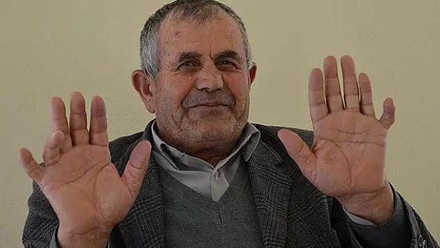 24 parmağıyla herkesi şaşırtıyor