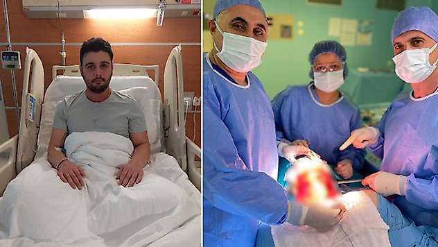 29 yaşındaki Hüseyin, kırık dişi yüzünden dil kanseri oldu