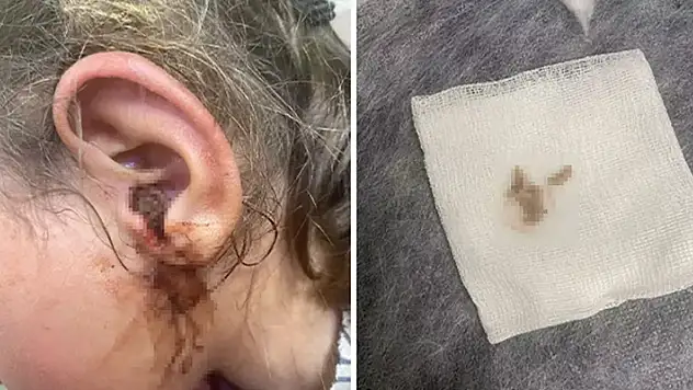 3 yaşındaki kızın kulağından çıkanlar şoke etti: 23 adet canlı çıkarıldı