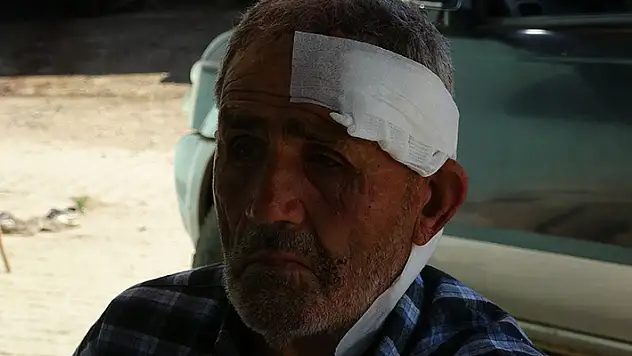 72 yaşındaki çoban, başıboş köpek saldırısında yaralandı
