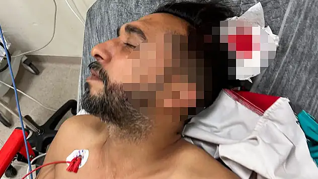 Adana'da döner ustası çalışırken başından yorgun mermiyle yaralandı