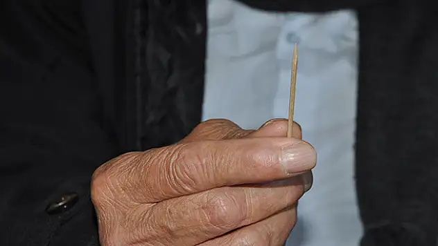 Akciğerinden çıkan 'kürdan' herkesi şaşırttı