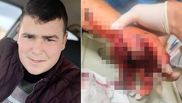 Aksaray'da korkunç olay! Nişanda ateşlediği hava fişek elinde patladı: Konya'da tedavi altına alındı

