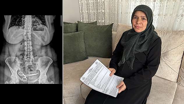 Ameliyatta karnında unutulan makasla 8 ay yaşadı

