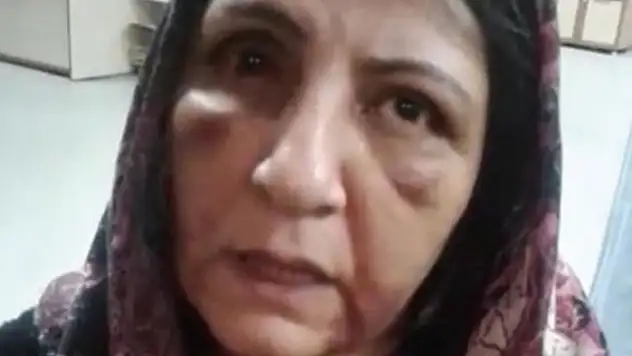 Annesini döverek hastanelik eden şahıs tutuklandı