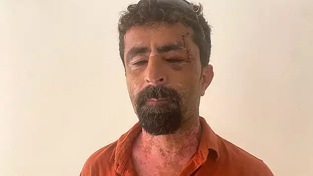 Antalya'da öfkeli damat kayınpederini hastanelik etti