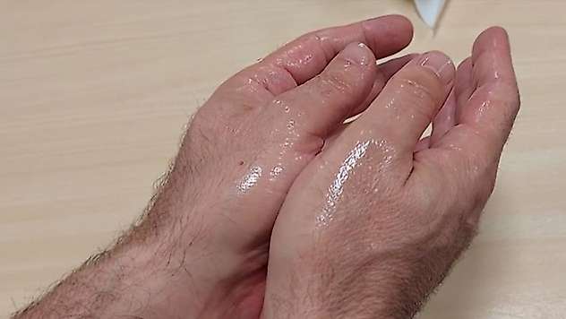 Aşırı terlemede krem tedavisi, ağır metal maruziyetine neden olabilir
