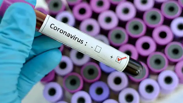 Avrupa'da virüs görülmeyen ülke kalmadı!