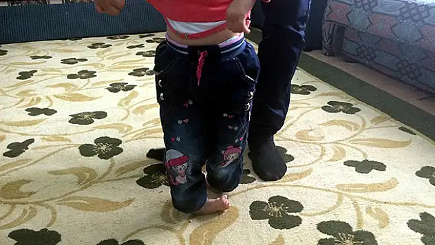 Ayakları eğri basan Esmanur yaşıtları gibi yürümek istiyor
