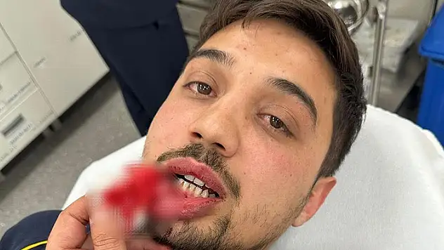 Baba ile oğlu, hasta taşıyan ambulansın önünü kesip sürücüyü darbetti 
