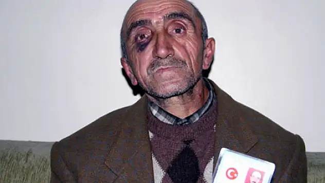 Babasını bedelli parası için dövdü!