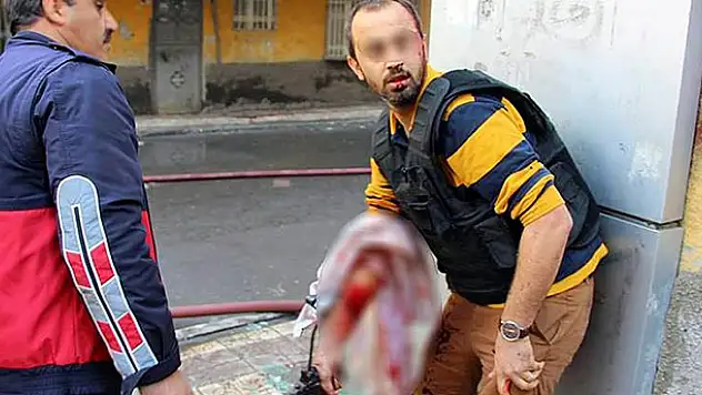 Bağlar'da polis yaralı halde silahı bırakmadı!