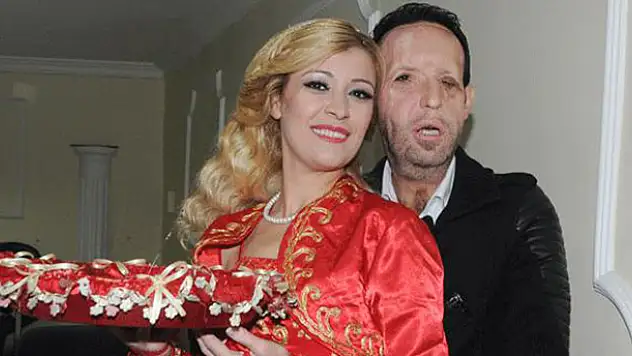 Beşinci yüz nakilli Recep Sert baba oluyor