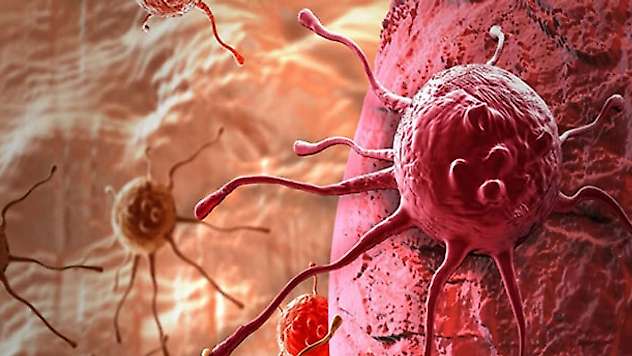 Bilim insanları denedi! Kanserin teşhisinde yeni dönem