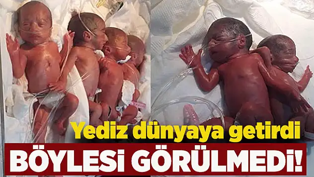 Bir kadın yediz dünyaya getirdi
