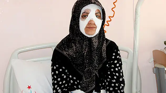 Bomba gibi patlayan düdüklü tencere genç kadına dehşeti yaşattı