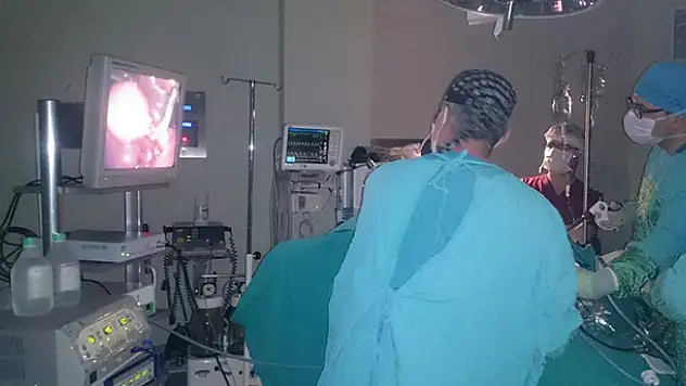 Bozkır'da kapalı yöntemle safra kesesi alınma ameliyatı