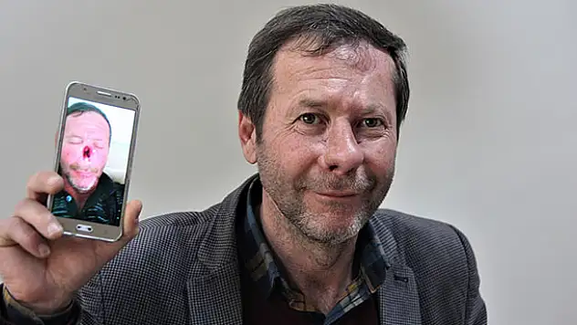 Burnuna 8 yıl sonra yeniden kavuştu