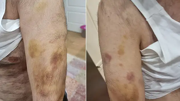 Büyükçekmece'de öğretmenin otizmli öğrenciyi darbettiği iddia edildi

