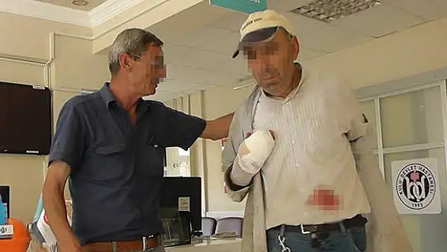 Çalışırken çekiçle kazara parmağını kopardı