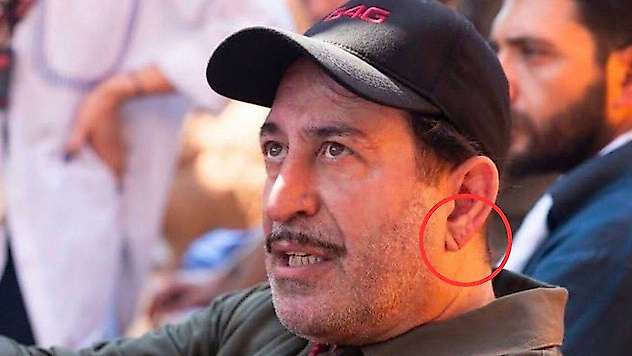 Cem Yılmaz'ın kulak memesi gündem oldu: 'Frank işareti' nedir?