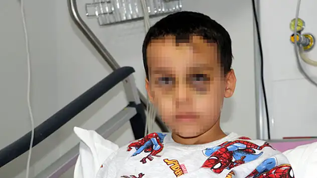Çocuk hizmetleri yurdunda feci darp iddiası! Kafatası kırıldı

