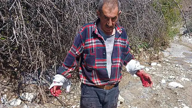 Çorum'da domuzun saldırdığı kişi yaralandı
